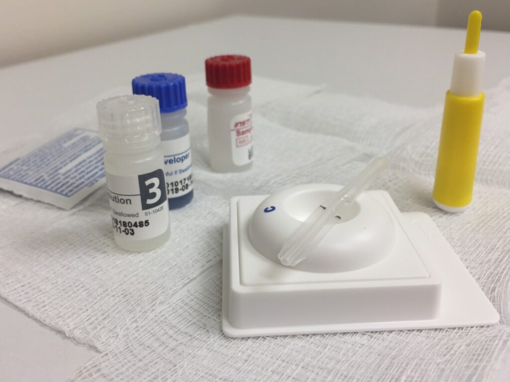 An HIV antibody test kit with reagent bottles and a pipette on a table